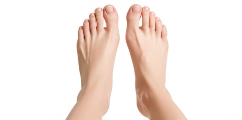 Feet showing bunion formation on the big toe