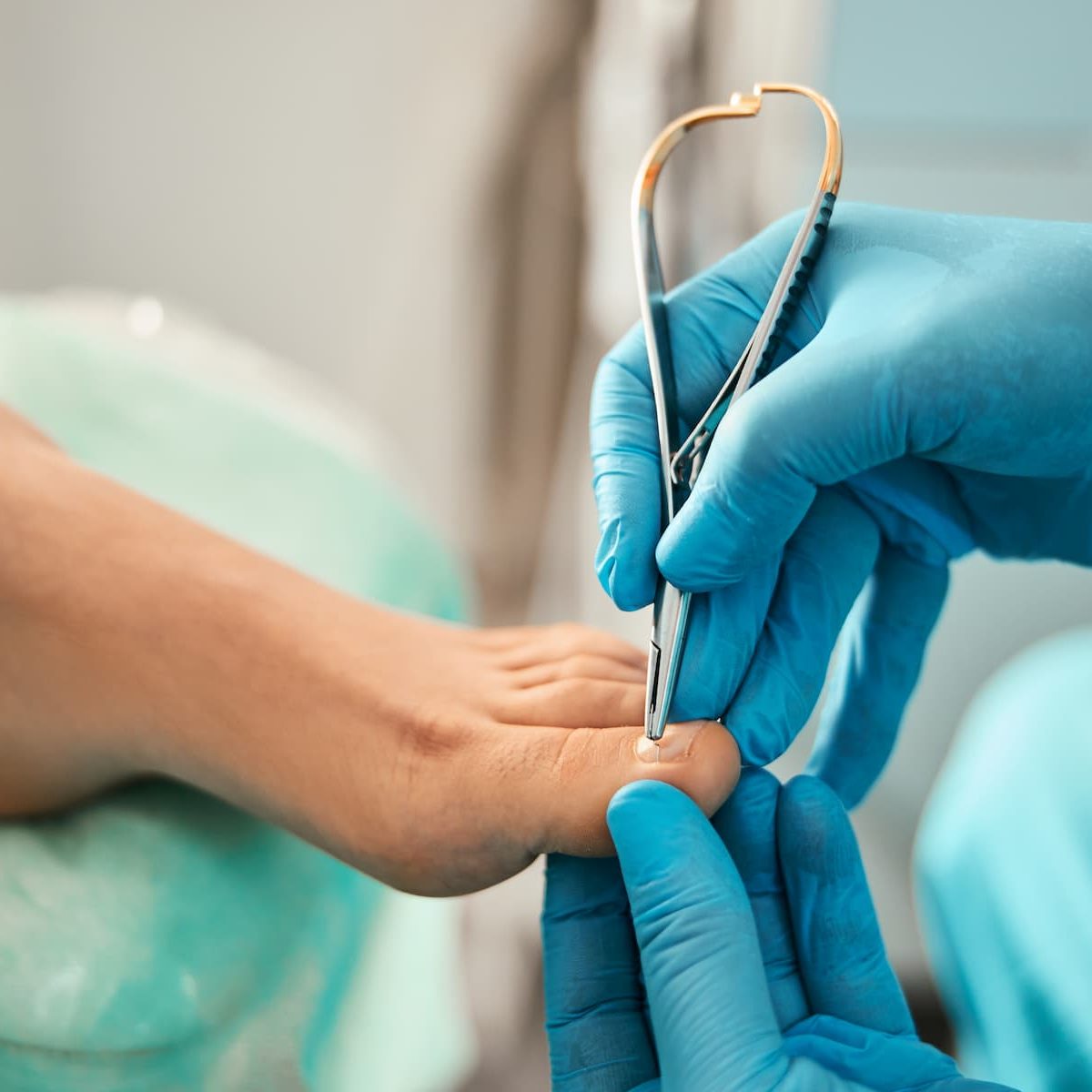 Ingrown toenail prevention